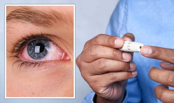 Close-up of a human eye showing signs of irritation, alongside a person holding a diabetes testing device, illustrating the connection between diabetes and eye health.