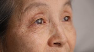 Symptoms of Having Cataracts