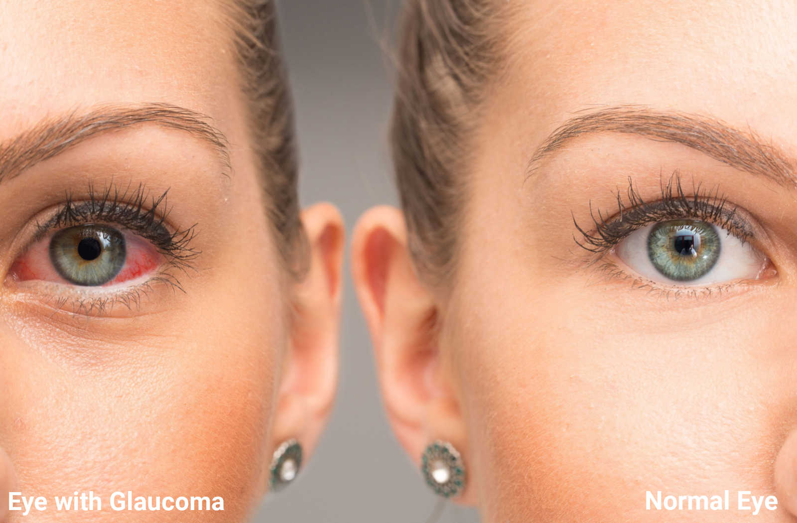 What Are the Early Warning Signs of Glaucoma?